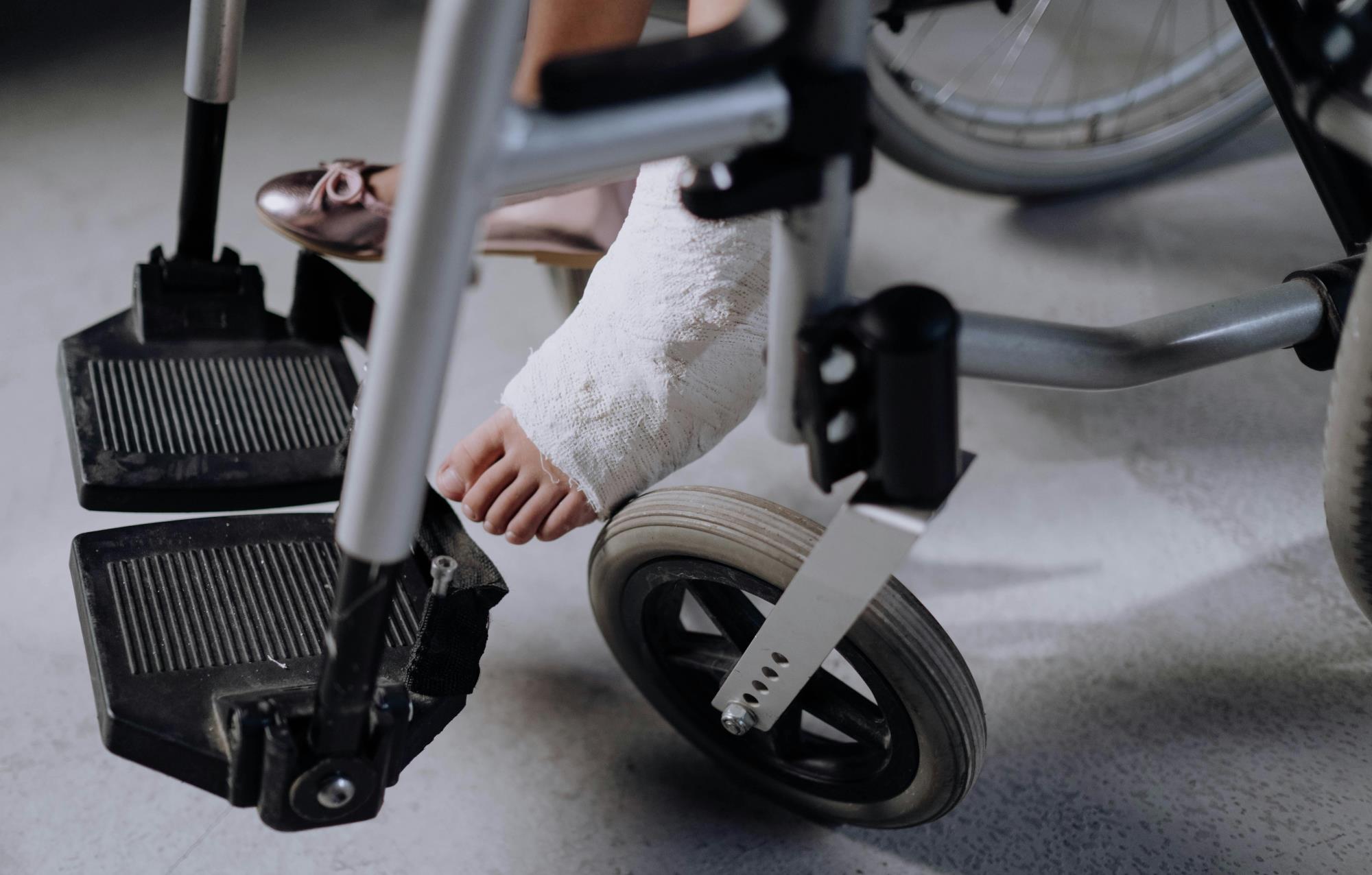 Female patient in a wheelchair with her foot in a cast.